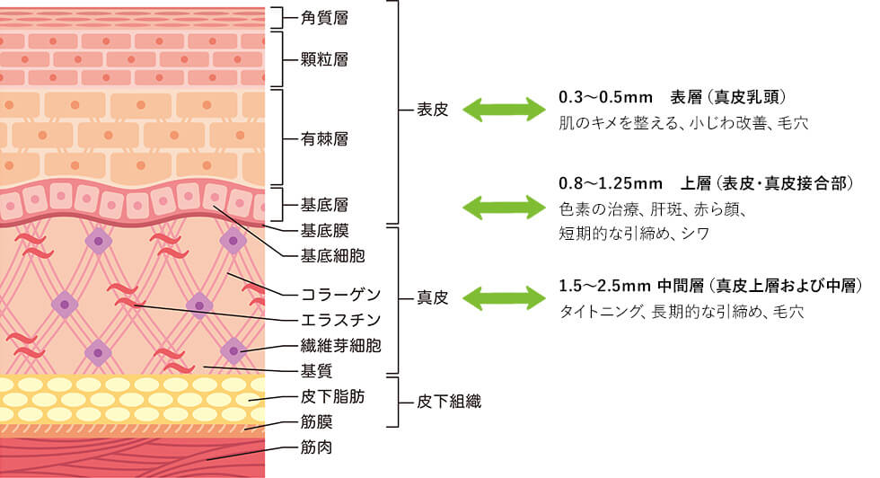 アプローチ層（当院での照射の場合）