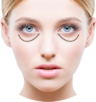 目の下のたるみ